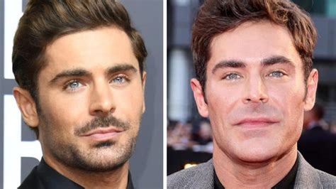 Did Zac Efron Have A Plastic Surgery Face Accident Before And After