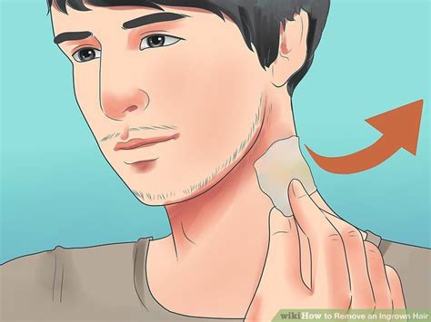Best products for ingrown hairs. 7 Effective Ways to Remove an Ingrown Hair - wikiHow