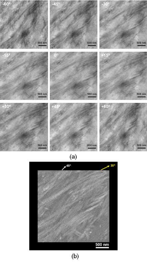 9 A A Representative Series Of Tem Micrographs Of Demineralized