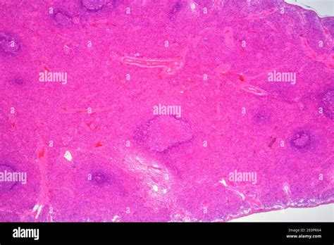 Human Spleen Lymphatic Organ Showing Capsules Red Pulp White Pulp