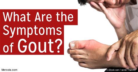 What Are The Symptoms Of Gout