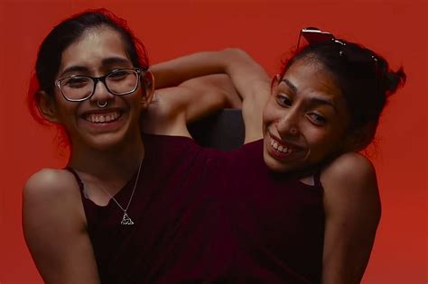 Who Are Carmen And Lupita Meet Tiktok’s Viral Conjoined Twins