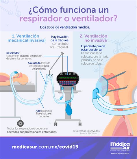 Médica Sur ¿cómo Funciona Un Respirador O Ventilador