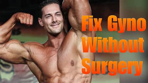 Gyno Cure Fix Without Surgery YouTube
