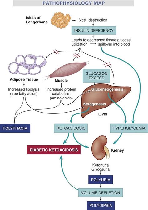 Your breathing may be very deep, and you could have a no one likes to think about dka, but it's best to be prepared. HESI Case Studies | Diabetic ketoacidosis, Ketoacidosis ...
