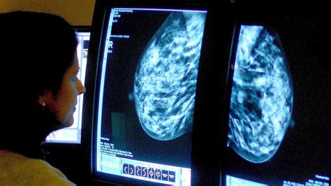 Capivasertib Scientists Hail ‘landmark New Drug For Treating Advancing Breast Cancer Itv News