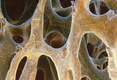 Spongy Bone Tissue Stock Image P1050065 Science Photo Library