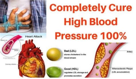 9 Instant Home Remedies For High Blood Pressure Right Home Remedies