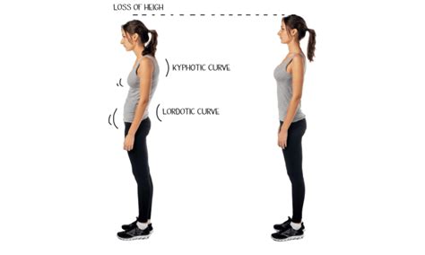 How To Improve Posture And Decrease Pain Tips From Our Pain Management