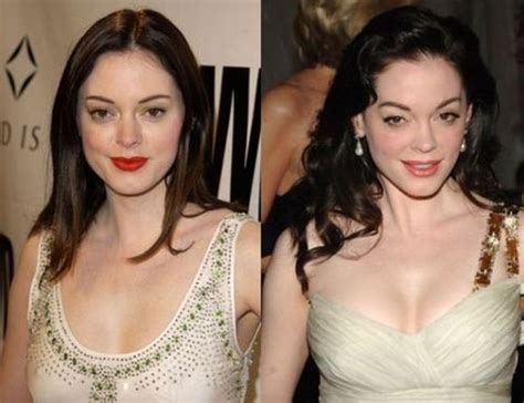 Rose Mcgowan Before And After Plastic Surgery 11 Celebrity Plastic Surgery Online