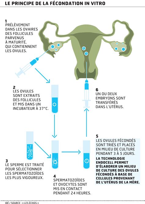 Fécondation in vitro culture sur mesure pour les embryons A