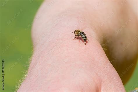 Biene Honigbiene Apis Mellifera Hinterlässt Ihren Stachel Mit