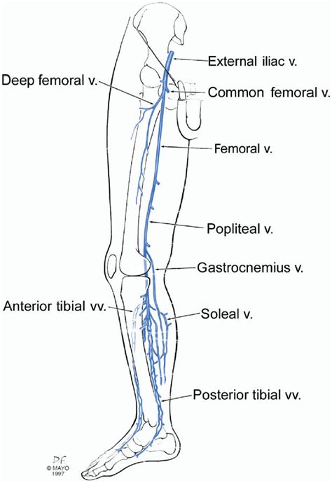 Figure 4 From The Hemodynamics And Diagnosis Of Venous Disease