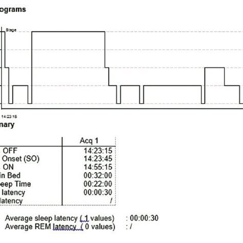 Electroencephalogram Showing Sleep Onset Rapid Eye Movement Sleep