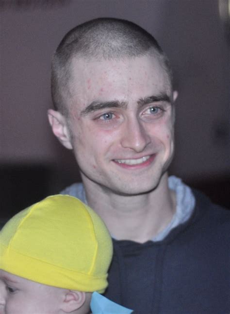 daniel radcliffe shaved his head for new movie role