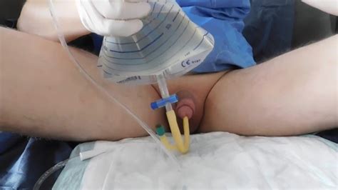 Filling The Bladder With An Inserted Catheter Ch Fr Pornhub Com