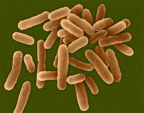 Legionnaires' disease, also known as legionellosis, is a form of atypical pneumonia caused by any type of legionella bacteria. La légionellose: définition et remèdes