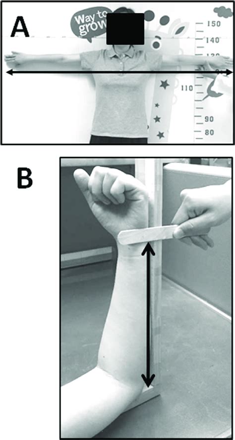 Illustrations Of Measurements Of The Arm Span Length A And Ulnar