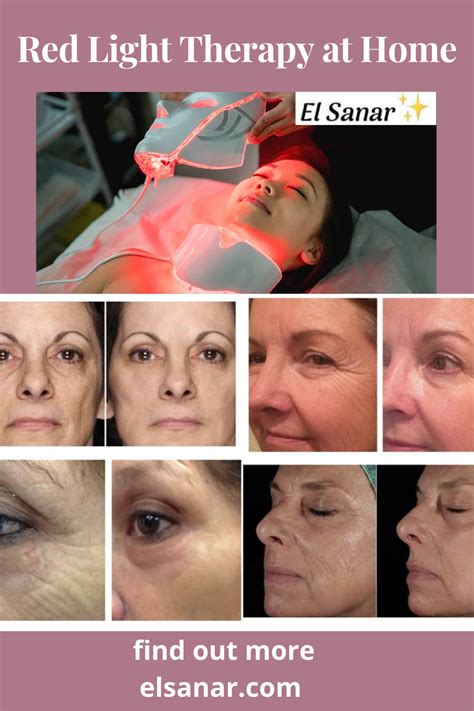 Red Light Therapy At Home Best Skincare Routine Product Antiaging