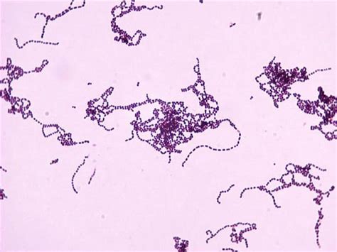 Streptococcus Pyogenes Group A Streptococci Microbiology