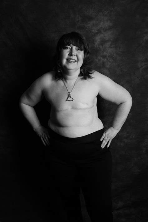Brave Breast Cancer Sufferers Show Their Mastectomy Scars In Powerful