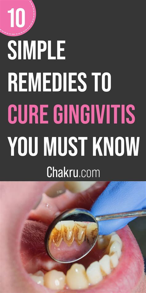 10 Natural Remedies For Gingivitis Gingivitis Natural Remedies Remedies