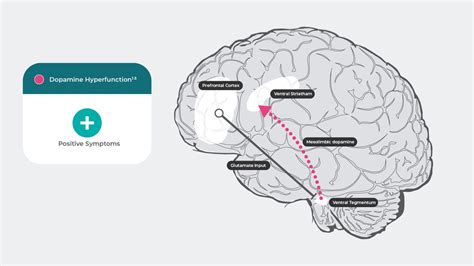 Four Major Dopaminergic Pathways And Association With Schizophrenia