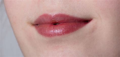 Maybe you would like to learn more about one of these? Herpes: tipos de herpes, complicaciones y prevención