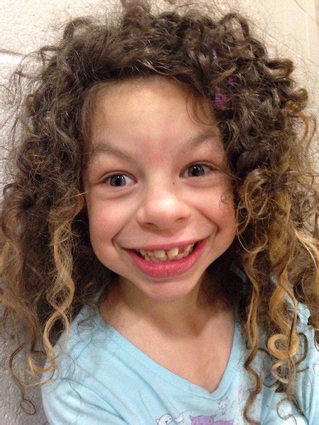 Management of patellofemoral pain syndrome. The Dreams of My Child With Williams Syndrome | The Mighty