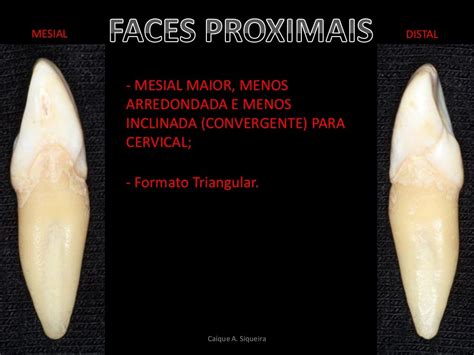 Face Proximal Do Dente