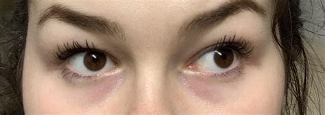 Skin Concerns Any Idea How To Reduce The Dark Circles Under My Eyes