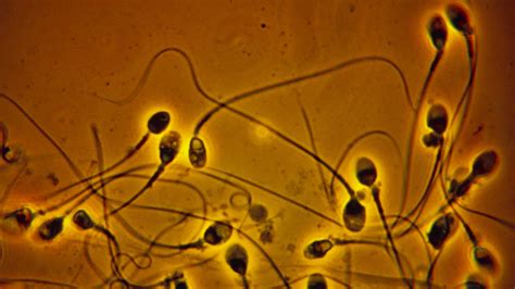 Sperm Count In Western Men Has Dropped Over 50 Percent Since 1973