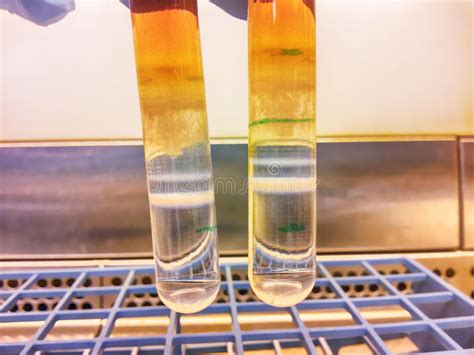 Virus purification stock photo. Image of gradient, fighting - 71072594