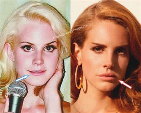 Lana Del Rey Before And After 2019