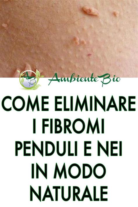 Solitamente, non provocano dolore e non rappresentano un pericolo;. Pin su Cosmesi Naturale