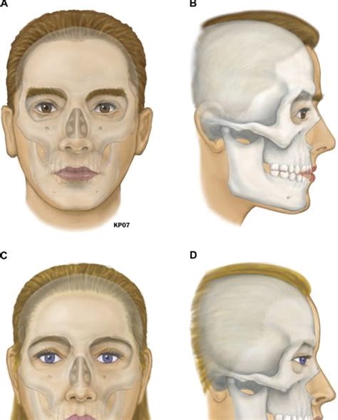 Mti Missing Tooth Investigators Male Skull Vs Female Skull Part 3