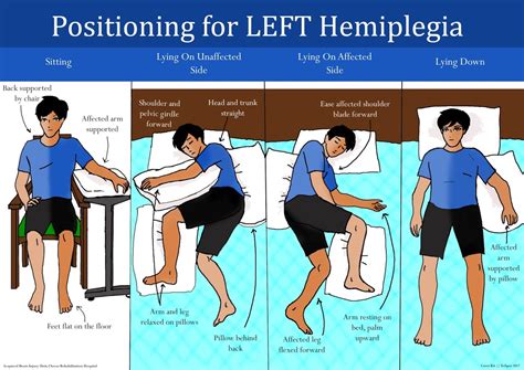 Caring For A Person Living With Stroke At Home How To Position A