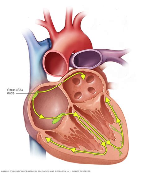 These are called demand pacemakers. Pacemaker - Drugs.com