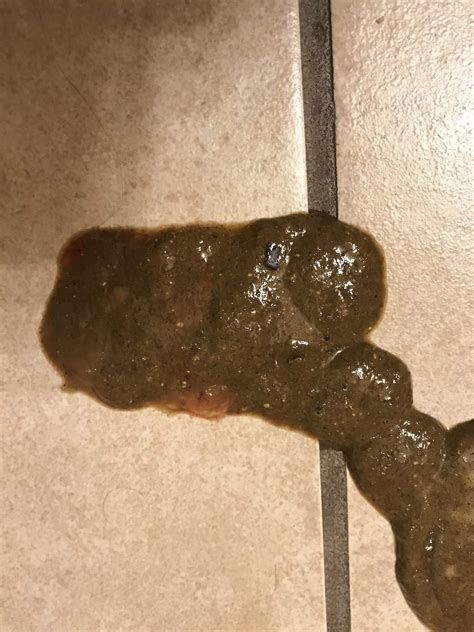 3 Month Old Pup With Diarrhea Golden Retriever Dog Forums