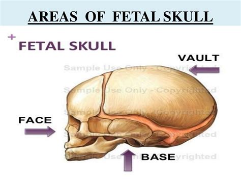 Ppt Fetal Skull Powerpoint Presentation Free Download Id11505739
