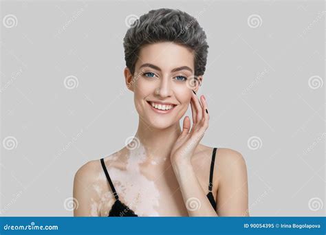 Vitiligo Woman Beauty Portrait Stock Image Image Of Beauty Adult