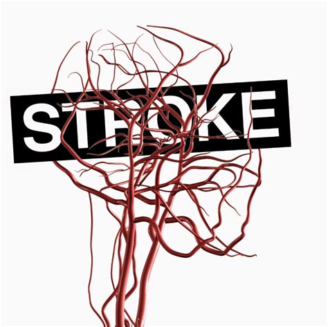 Stroke The Second Leading Cause Of Death In The World ~ Publicwellness