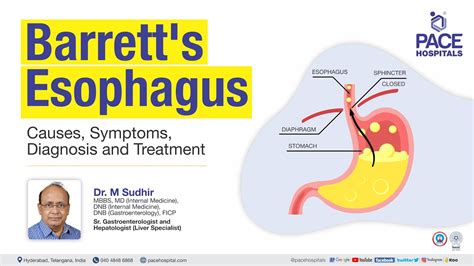 Barrett S Esophagus Causes Symptoms Diagnosis Treatment