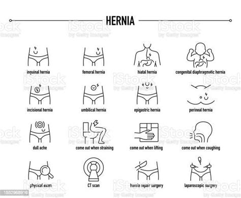 Ilustración De Síntomas De Hernia Conjunto De Iconos De Vectores De
