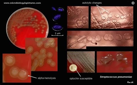Características Del Streptococcus Pneumoniae Streptococcus Pneumoniae