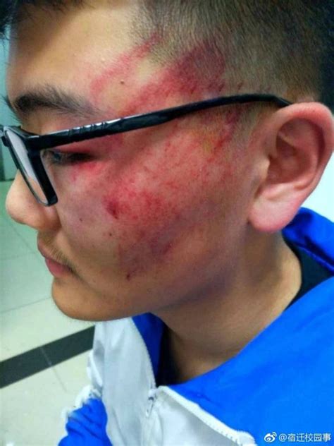 High School Teacher In China Fired After Viciously Slapping Students Face
