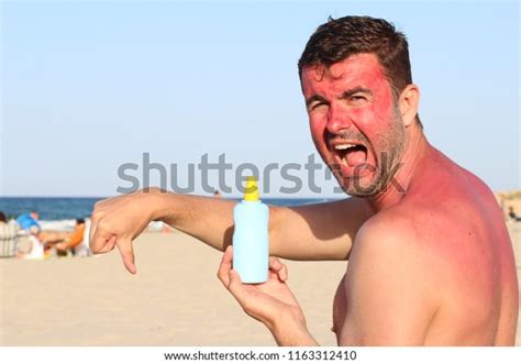 Man Getting Sunburned Beach Stock Photo 1163312410 Shutterstock