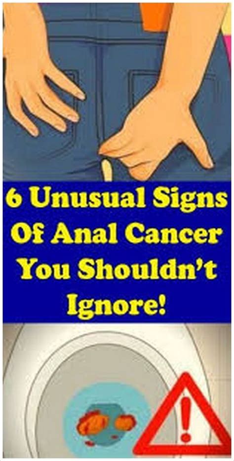 Early Warning Signs Of Anal Cancer Artofit