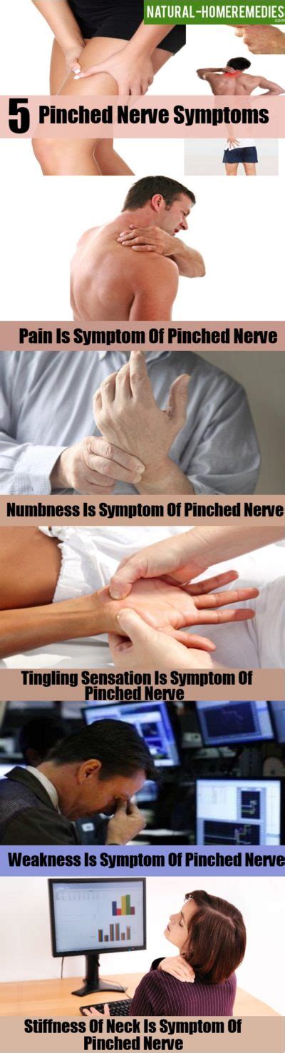 5 Pinched Nerve Symptoms How To Identify Pinched Nerve Natural Home