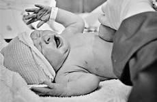 circumcision baby father mom regret pros cons
